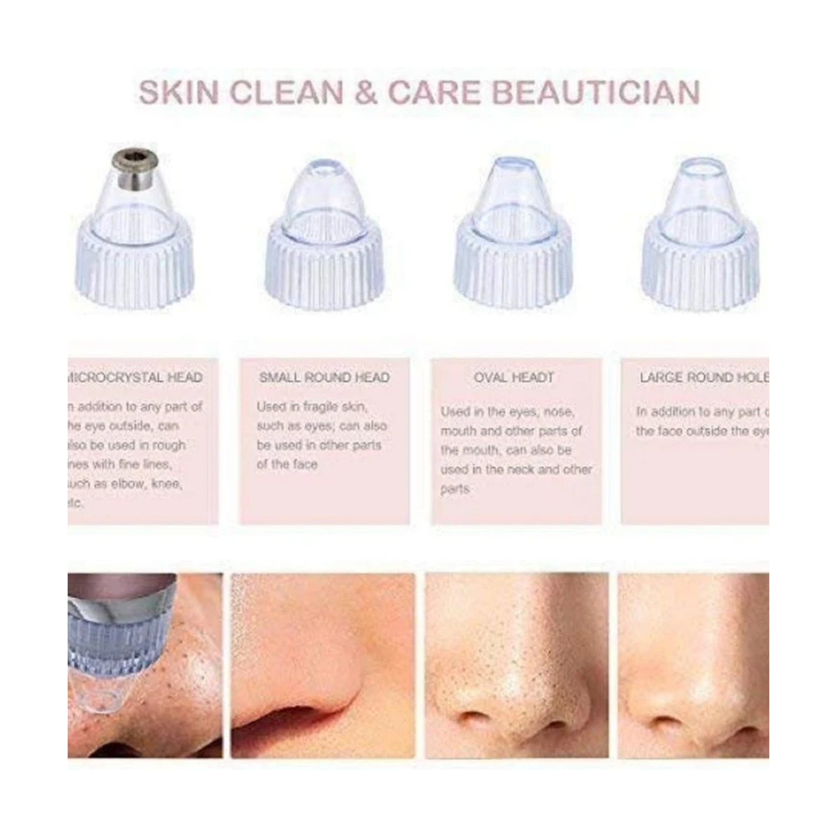 Pore Cleaning Device – Electric Facial Pore Cleaner & Blackhead Remover