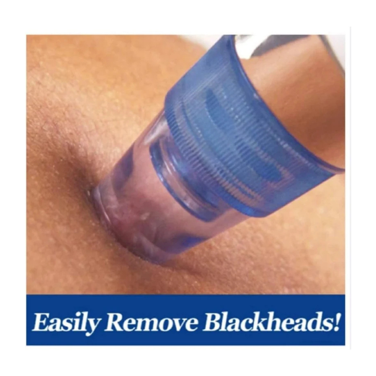 Pore Cleaning Device – Electric Facial Pore Cleaner & Blackhead Remover